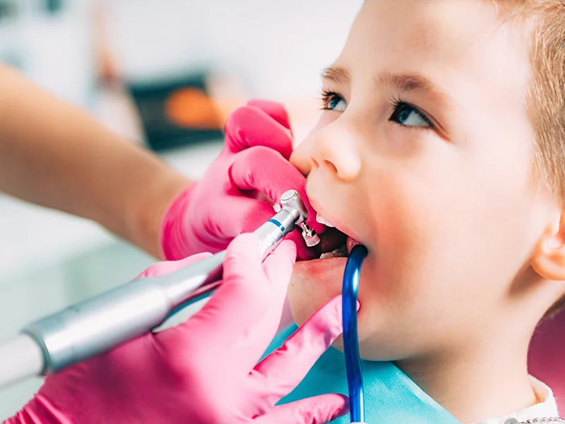 odontopediatria tratamientos en pozuelo y aravaca - clinica dental cruz benito