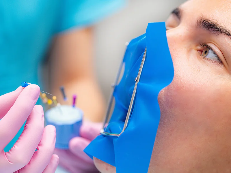 endodoncia dental tratamiento