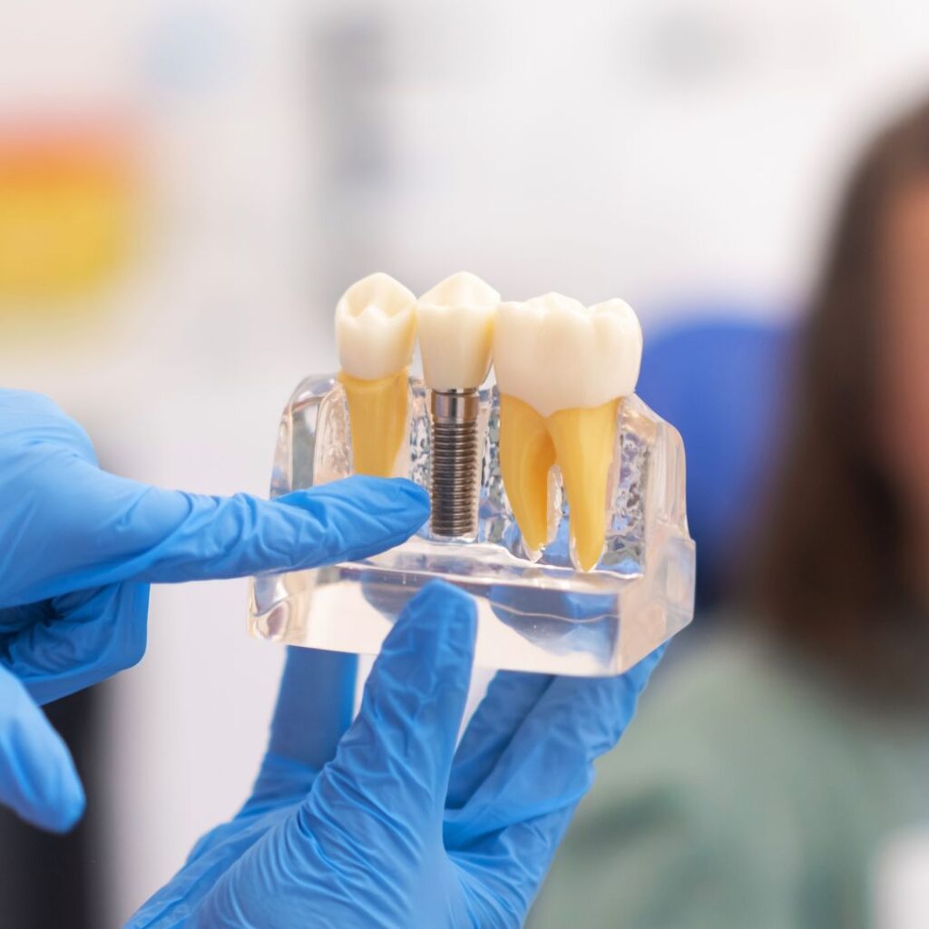 efectivas de cuidar sus implantes dentales